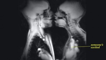 כך נראה משגל מבעד לסורק MRI