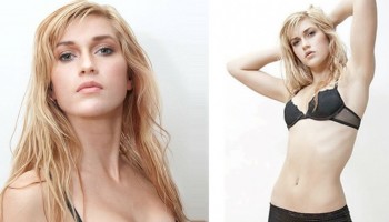 כך נראית היום הבחורה הזאת שעברה יותר מ-15 ניתוחים כדי להיראות כמו דמות מצוירת