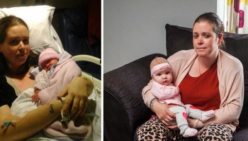 מצמרר: צעירה שנכנסה לניתוח קיסרי לא דמיינה שתתעורר 6 ימים אחרי ותגלה את הדבר המזעזע הבא