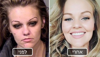 25 תמונות לפני-אחרי של אנשים שהצליחו להיגמל משימוש בסמים קשים