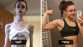 25 תמונות לפני ואחרי של נשים שהצליחו לנצח את האנורקסיה